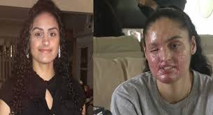 پاکستانی میڈیکل سٹوڈنٹ نافیہ اکرام پر تیزاب پھینکنے والا شخص5 سال بعد گرفتار